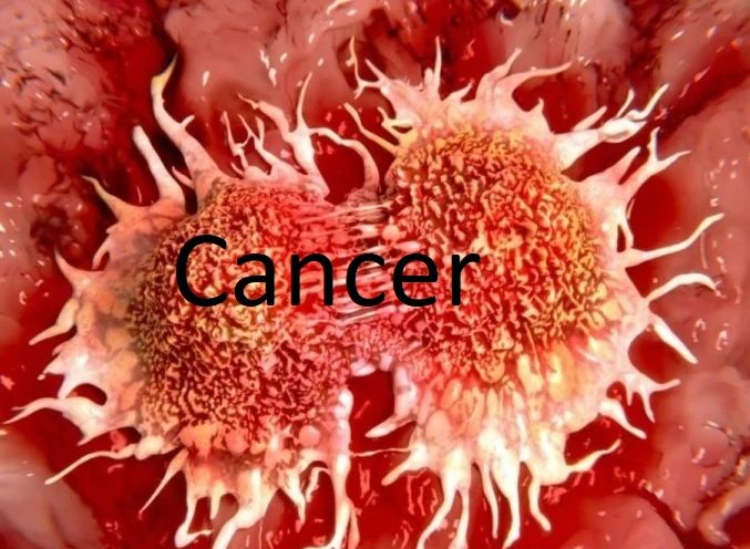cancer cases will frise 12 percent by 2025
